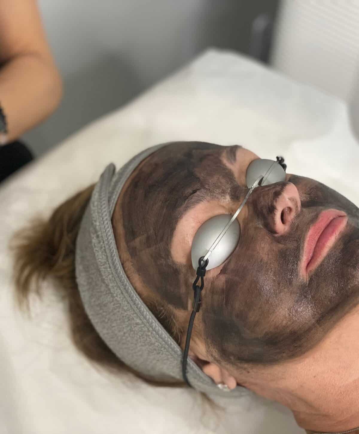 Patient receiving a professional carbon laser peel with facial mask.