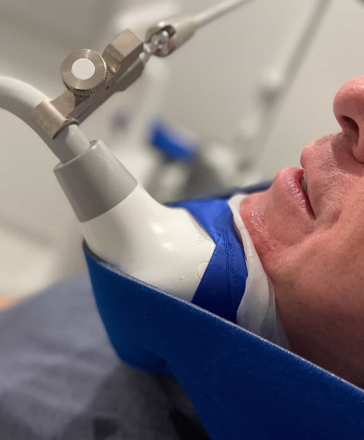 A patient undergoing a CoolSculpting Elite procedure on the submental (under chin) area to reduce stubborn fat.