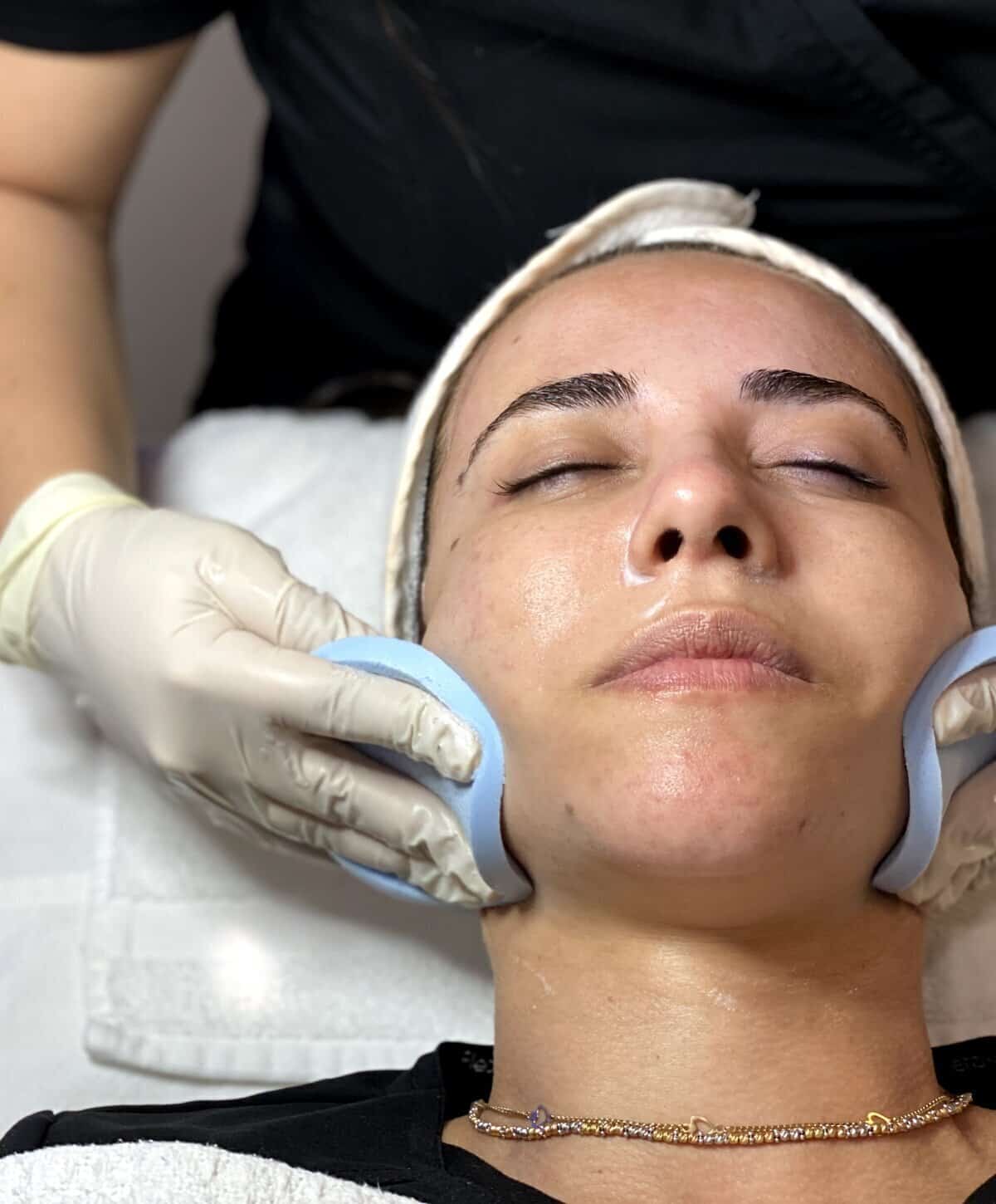 A patient receiving a professional facial contouring treatment using specialized blue applicator tools on the jawline.