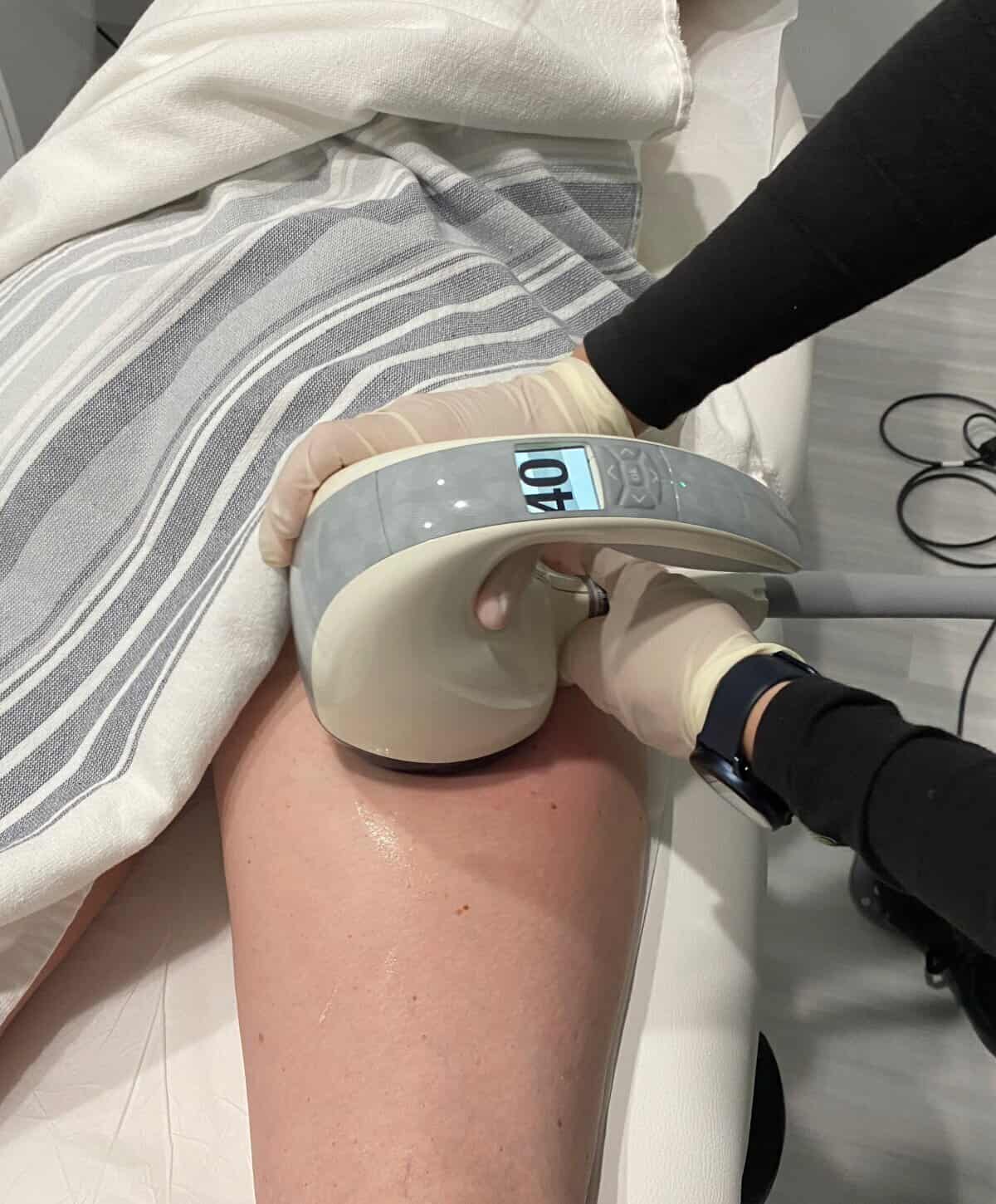Close-up of body contouring treatment on a thigh.