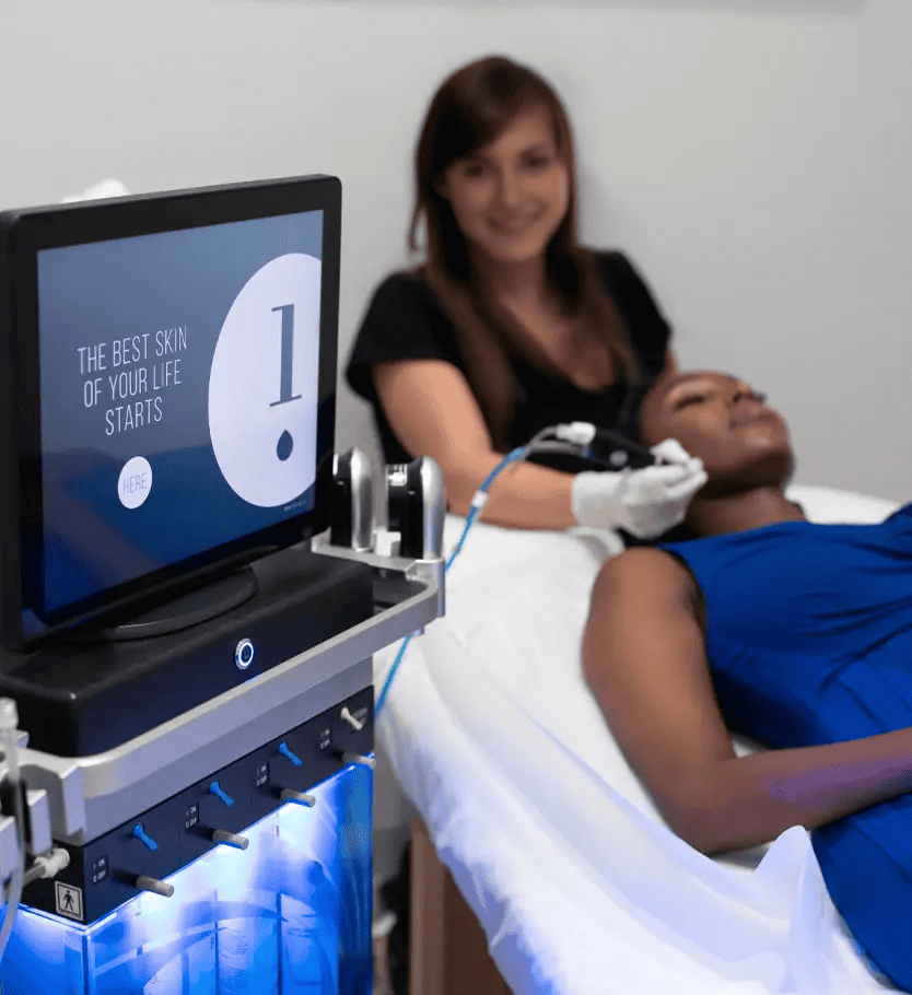 Microneedling treatment in progress.