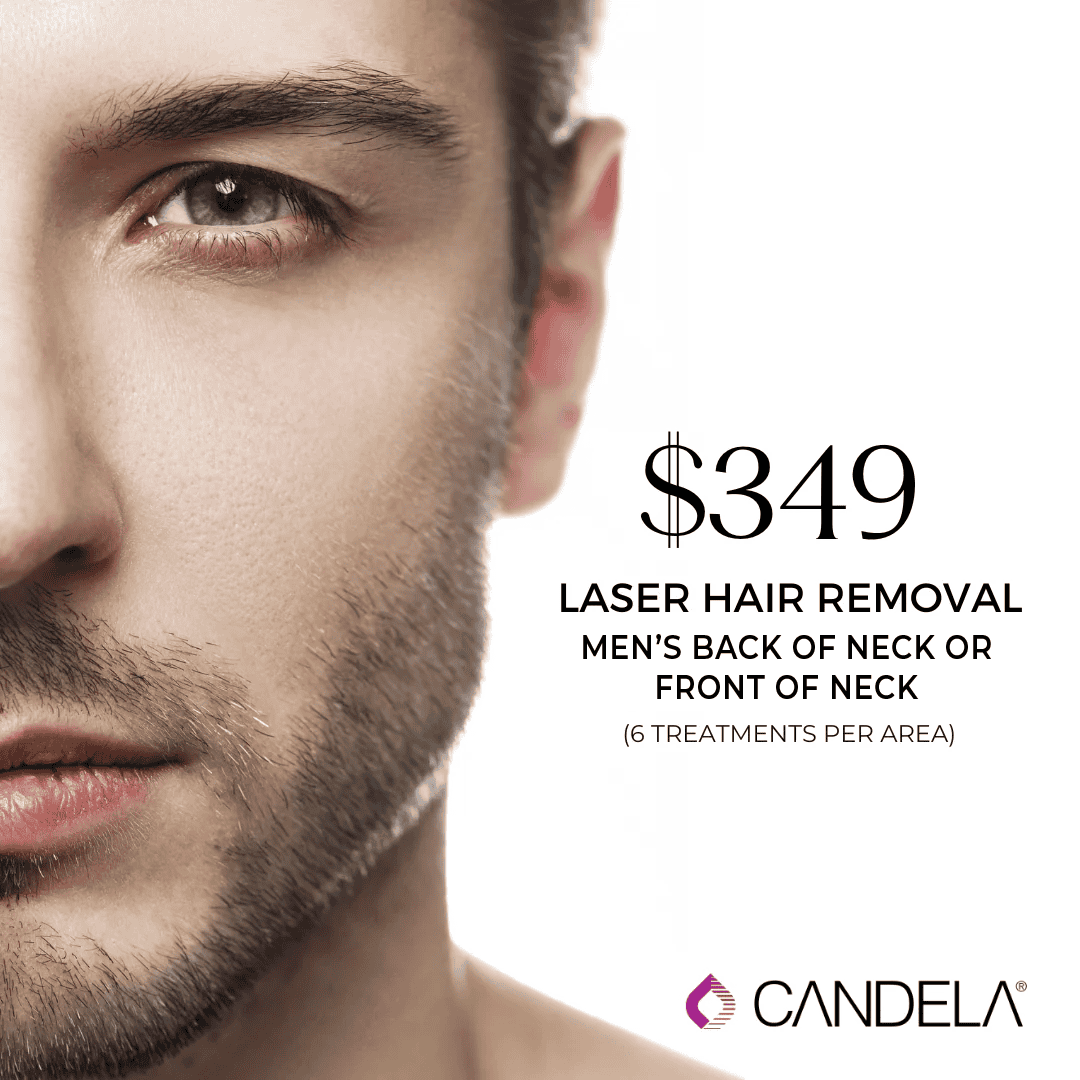 Beard or Back of Neck Laser Har Removal